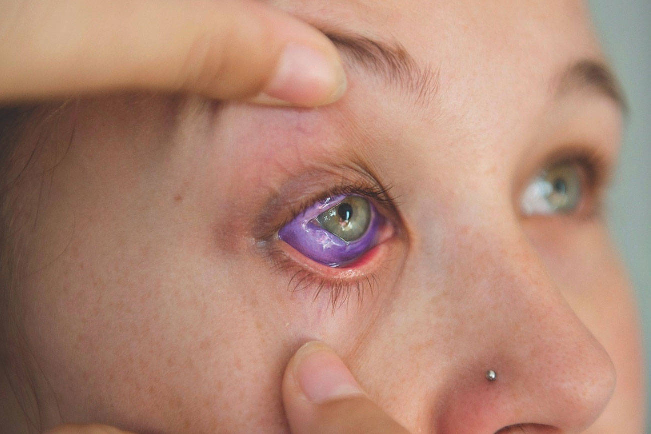 Law would prohibit eye tattoos in Washington state