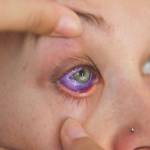 Law would prohibit eye tattoos in Washington state