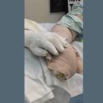 Jamie and Jacob Hyland touching hands while recovering from serious burns from fleeing a wildfire earlier this month. Courtesy photo/Harborview Medical Center.