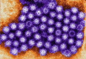 norovirus file photo